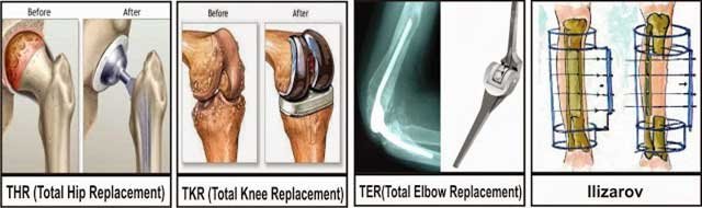 Peralatan Radiologi Modern